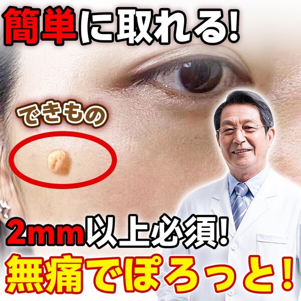 FERNIDA イボ取り除去きっと フットケア スギンタクリムーバーツール 2mm~9mm 自分で取り外す 88個バンドセット 3in1キット 顔 首 頭 脇 体 男女兼用 日本語取り扱い付き フットケア用品