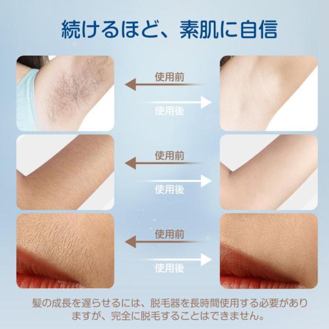 限定特典】冷感脱毛器 冷却 全身脱毛 IPL光脱毛器 全身 VIO対応 だつ