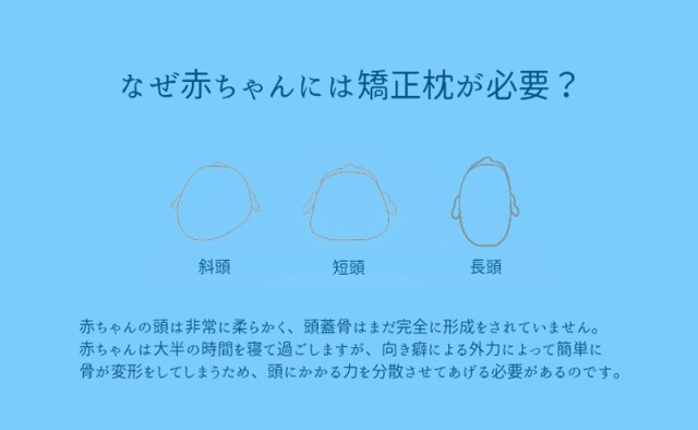 ベビー枕 ドーナツ枕 新生児 頭の形 絶壁 頭形矯正 寝はげ防止 寝返り防止 安眠 クマ パステルカラー かわいいの通販はau Pay マーケット プラスナオ