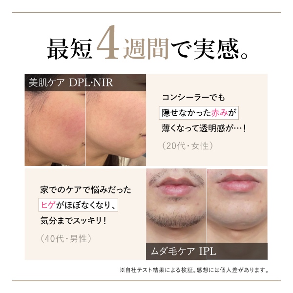 在庫あり　脱毛器 光美容器 WAVEWAVE Radiant Grace 家庭用 光脱毛器 IPL NIR DPL ワキ ヒゲ うぶ毛 VIO 全身 メンズ レディース WB44-01-WH_4