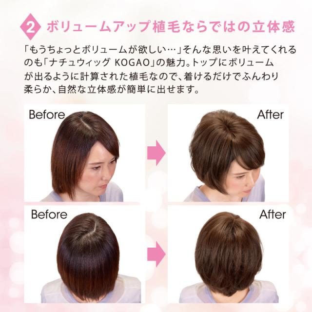 ナチュウィッグ KOGAO ブラウン (巾着付き) (送料無料 ボリュームアップ 小顔効果 白髪隠し UV 抗菌仕様 人工皮膚ネット)《ティーライフ》