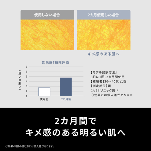 【長期保証付】パナソニック(Panasonic) ES-WH7C-W 光エステ スムースエピ フェイス＆ボディ＆VIO用 脱毛器 SMOOTHEPI COMPACT 手軽コンパクトモデル_6