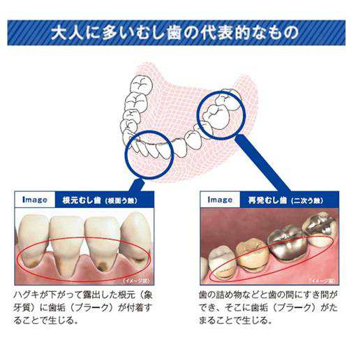 サンスター バトラー エフペーストα(90g*12本セット)[歯磨き粉 その他]