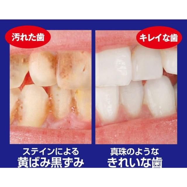 歯のホワイトニング 薬用重曹ステインプロ ストロング 医薬部外品の通販はau Pay マーケット 株式会社ママリボーン