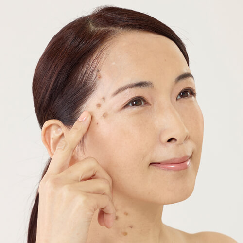 超超際＆ラリー！ポイント最大13％還元！】イポロン G 150g 3本セット