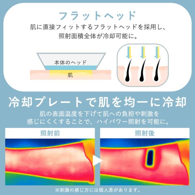 ラッピング対象／光美容器 ミコラ セルフケア 全身ケア ムダ毛ケア
