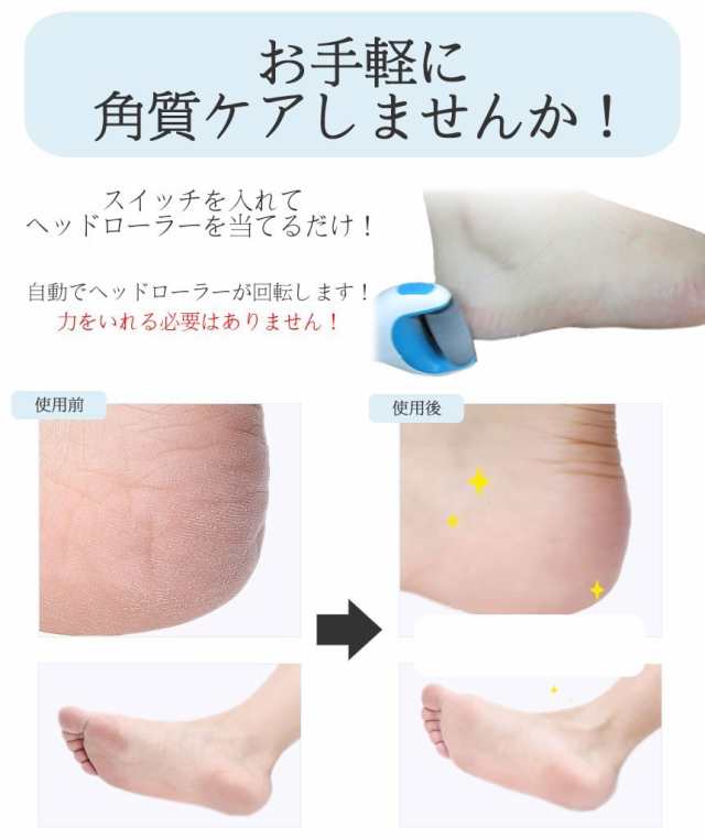 未使用‼️KOIZUMI 充電式角質ケア FOOT REMOVER - 健康