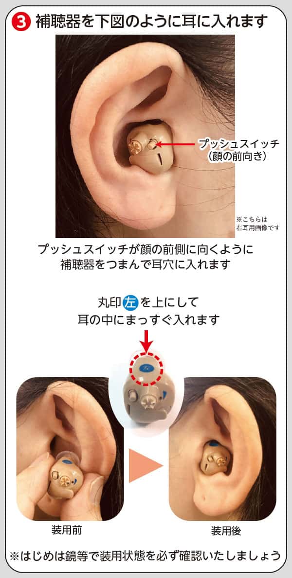 ニコン・エシロール 補聴器 左耳用【NEF-M100-L】デジタル補聴器 耳あな型補聴器 正規品 電池式 集音器 耳穴型補聴器 耳穴式 片耳用 軽度 中等度 難聴 ハウリングキャンセラー ボリュームダイヤル搭載 音質切り替え 日本製 【メーカー直送：代引き不可】