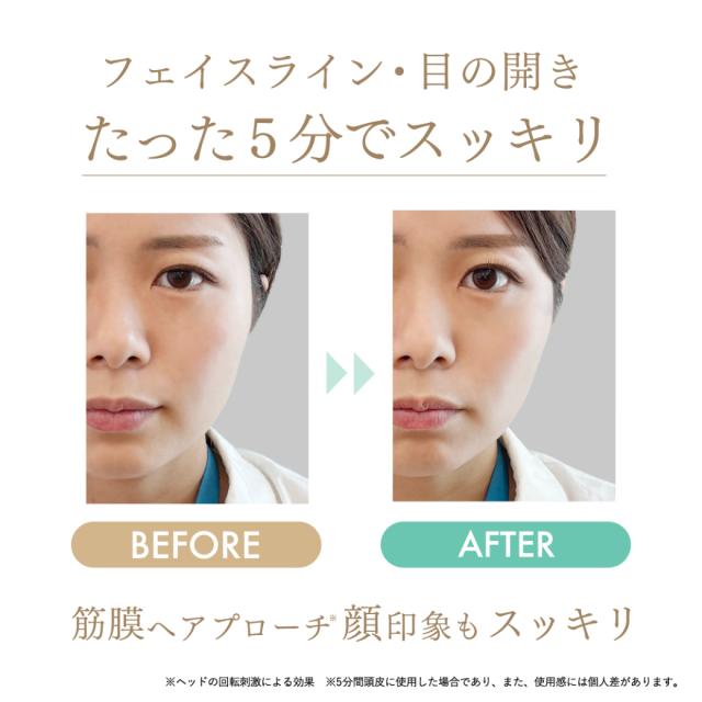スカルプD ボーテ ビューティーヘッドスパ 美容 口コミ リフトケア フェイスライン 頭皮 プロ 頭皮マッサージ 効果 アンファー_7