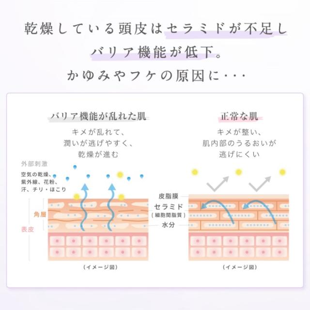 【送料無料】スカルプD ボーテ　薬用　頭皮保湿美容液　2本セット アンファースカルプD ボーテ　薬用 頭皮保湿美容液［ 頭皮化粧水 地肌 乾燥 頭皮湿疹 かゆみ ケア ローション 化粧水 ふけ フケ 人気 皮膚炎 セラミド 赤ちゃん 女性］_3