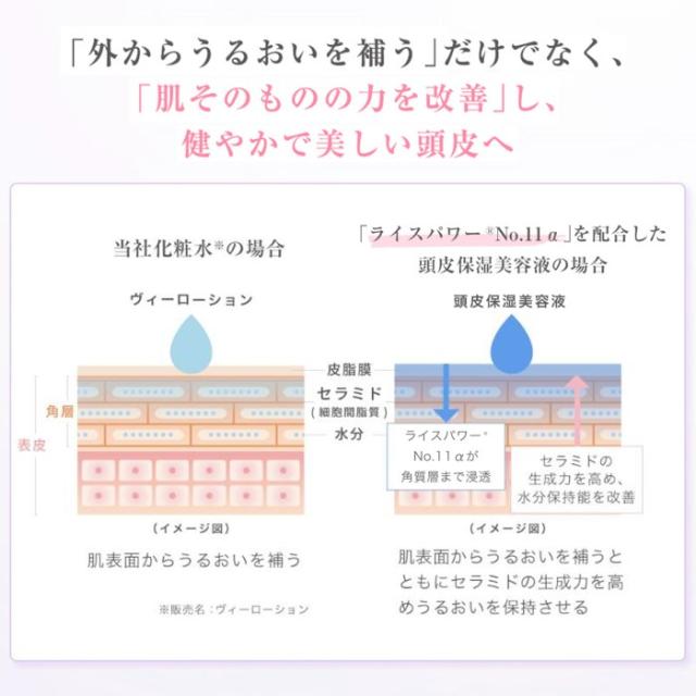 【送料無料】スカルプD ボーテ　薬用　頭皮保湿美容液　2本セット アンファースカルプD ボーテ　薬用 頭皮保湿美容液［ 頭皮化粧水 地肌 乾燥 頭皮湿疹 かゆみ ケア ローション 化粧水 ふけ フケ 人気 皮膚炎 セラミド 赤ちゃん 女性］_5