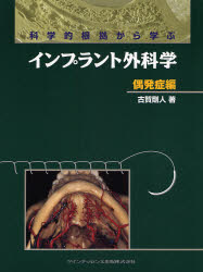 【新品】【本】科学的根拠から学ぶインプラント外科学　偶発症編　古賀剛人/著