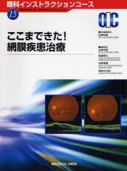 【新品】【本】ここまできた!網膜疾患治療　白神史雄/担当編集委員