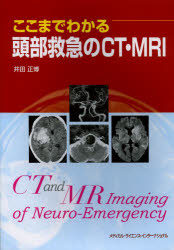 【新品】【本】ここまでわかる頭部救急のCT・MRI　井田正博/著 7,200円