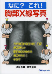 【新品】【本】なに?これ!胸部X線写真　池田貞雄/著　畠中陸郎/著