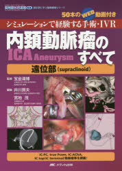 【新品】内頚動脈瘤〈ICA　Aneurysm〉のすべて遠位部〈supraclinoid〉　シミュレーションで経験する手術・IVR　50本のWEB動画付き　宝金
