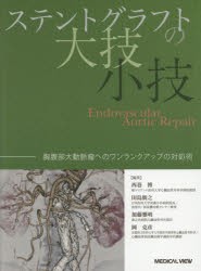 ステントグラフトの大技・小技 胸腹部大動脈瘤へのワンランクアップの