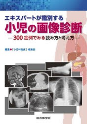 エキスパートが鑑別する小児の画像診断　300症例でみる読み方と考え方　「小児科臨床」編集部/編集の通販は