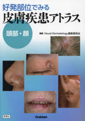 好発部位でみる皮膚疾患アトラス　頭部・顔　Visual　Dermatology編集委員会/編集