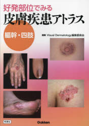 好発部位でみる皮膚疾患アトラス　躯幹・四肢　Visual　Dermatology編集委員会/編集