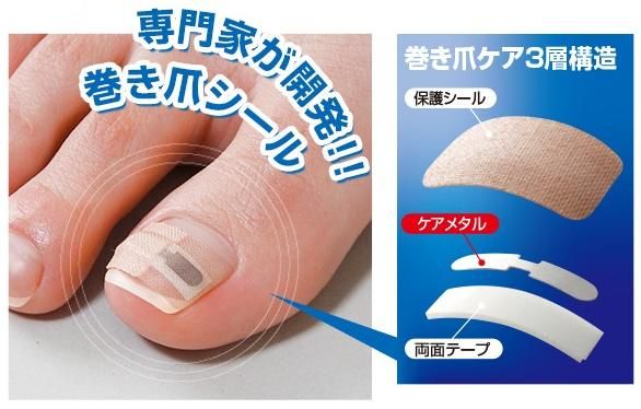 ネコポス発送 送料250円 爪 テーピング 巻き爪シール お得用 ４ヶ月セット の通販はau Pay マーケット Lunebeauty店