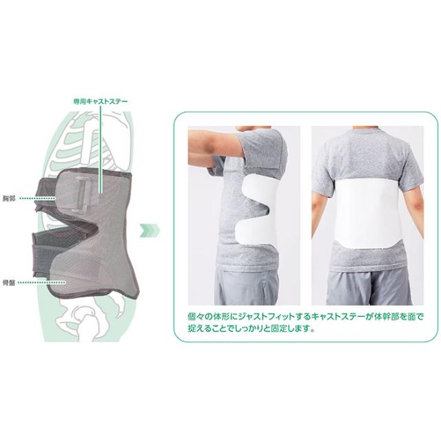 ALCARE アルケア フィットキュア・ランバー SSサイズ 腰椎用 一般医療機器 Fit Cure カバー付きキャスティングシステム キャストステー_4