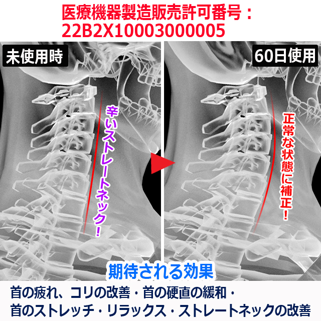一般医療機器 Tech Loveダイヤル式ネックストレッチャーPRO 牽引 首 頸椎 ストレートネック 家事 デスクワワーク ストレッチ 硬直 肩_7