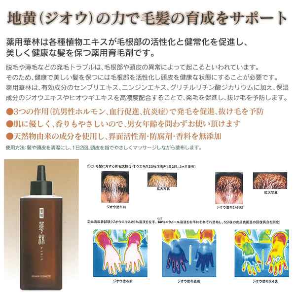 薬用育毛剤 華林 150ml 女性用 男性用 効果ある 薄毛の悩み 抜け毛予防 発毛期待 発毛促進 男女兼用 医薬部外品 頭皮血行促進 発毛サの通販はau Pay マーケット 株式会社ポニー