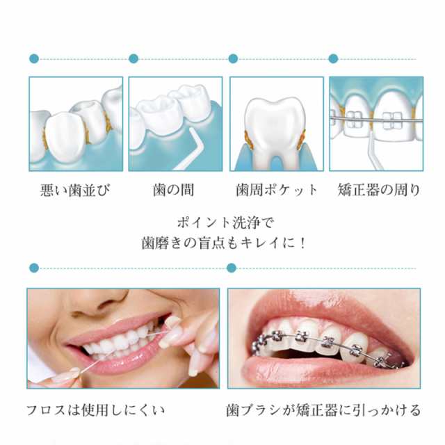 口腔洗浄器 ウォーターピック 歯ジェットウォッシャー 口腔洗浄機 歯