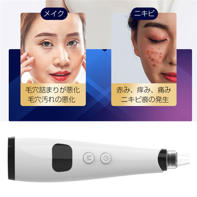 毛穴洗浄ピーリングと肌引き締めローラーつき美顔器 毛穴吸引器 フェイスローラー 毛穴クリーン 毛穴汚れ吸引 ニキビ吸引