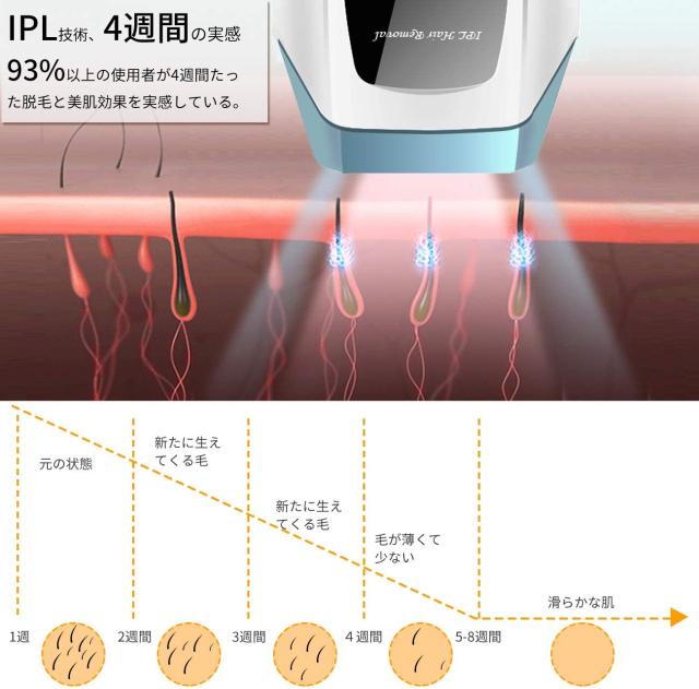 IPL 光脱毛器 100万発 お肌に優しいIPL技術 家庭用エステ
