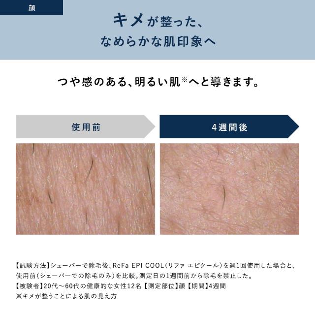ReFa 公式 エピ クール ムダ毛 ハイパワー ツルスベ ボディケア VIO 顔 脇 ワキ メンズ 除毛 家庭 EPI COOL リファ クーポン_8