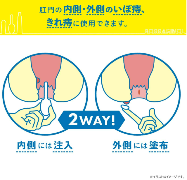 【第(2)類医薬品】天藤製薬 ボラギノールA 注入軟膏（2g×30個）6個セット 【送料無料】_2