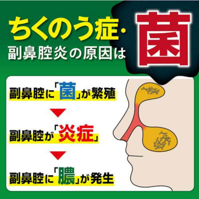 【第2類医薬品】小林製薬 チクナインc 点鼻スプレー 30ml 6個セット【送料無料】【セルフメディケーション税制対象】_2