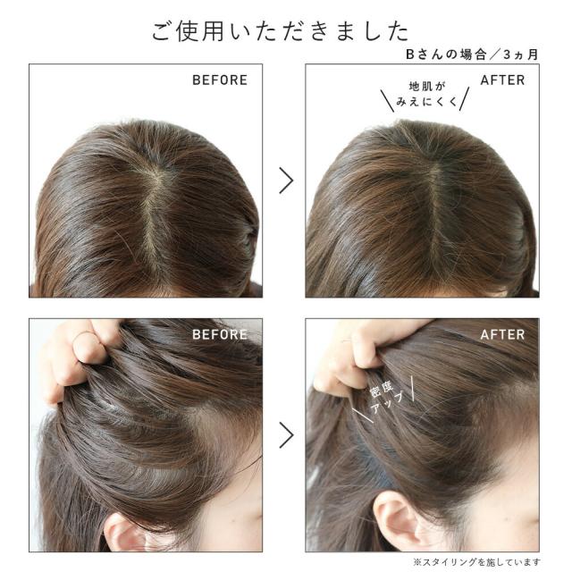 【レビュー投稿で+5%還元】【医薬部外品】【3本セット】育毛剤 女性用 薬用ウーマンスカルプセラム 150ml 日本製 抜け毛対策 頭皮 薄毛 レディース ナチュラル 植物成分 スキンケア 保湿 予防 抜け毛 ヘアケア ローション ジェットノズル マッサージ 低刺激【hinna】ヒンナ_10