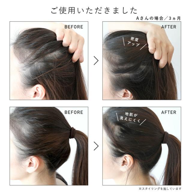 【レビュー投稿で+5%還元】【医薬部外品】【3本セット】育毛剤 女性用 薬用ウーマンスカルプセラム 150ml 日本製 抜け毛対策 頭皮 薄毛 レディース ナチュラル 植物成分 スキンケア 保湿 予防 抜け毛 ヘアケア ローション ジェットノズル マッサージ 低刺激【hinna】ヒンナ_9