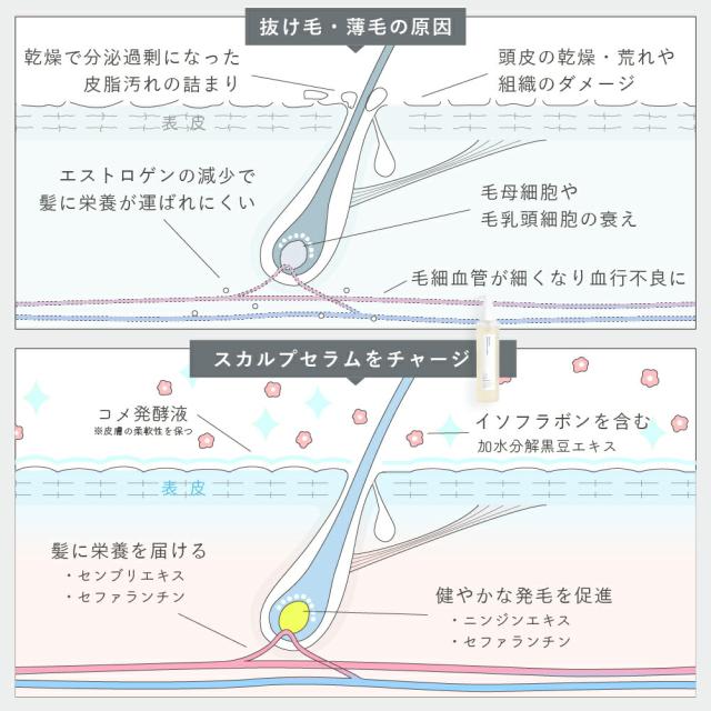 【レビュー投稿で+5%還元】【医薬部外品】【3本セット】育毛剤 女性用 薬用ウーマンスカルプセラム 150ml 日本製 抜け毛対策 頭皮 薄毛 レディース ナチュラル 植物成分 スキンケア 保湿 予防 抜け毛 ヘアケア ローション ジェットノズル マッサージ 低刺激【hinna】ヒンナ_5