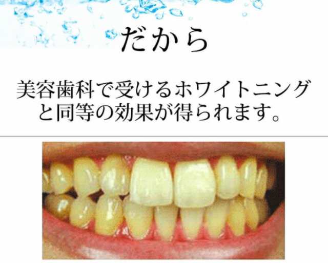 ＼ポイント消化！／ 薬用パールホワイトプロ EXプラス [30ml] ホワイトニング 歯磨き液 薬用PearlWhite Pro EX＋ ホームホワイトニング 歯磨き粉 黄ばみ ヤニ 口臭の通販は
