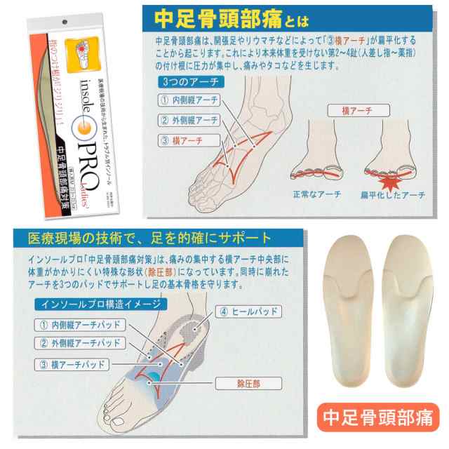 春新作 インソール レディース 中敷き 衝撃吸収 O脚 腰痛 ひざ痛 外反母趾 偏平足 中足骨頭部痛 足底筋膜炎 モートン病 シューズケア 日の通販はau Pay マーケット レディース靴の店shop Kilakila ショップキラキラ 全品送料無料
