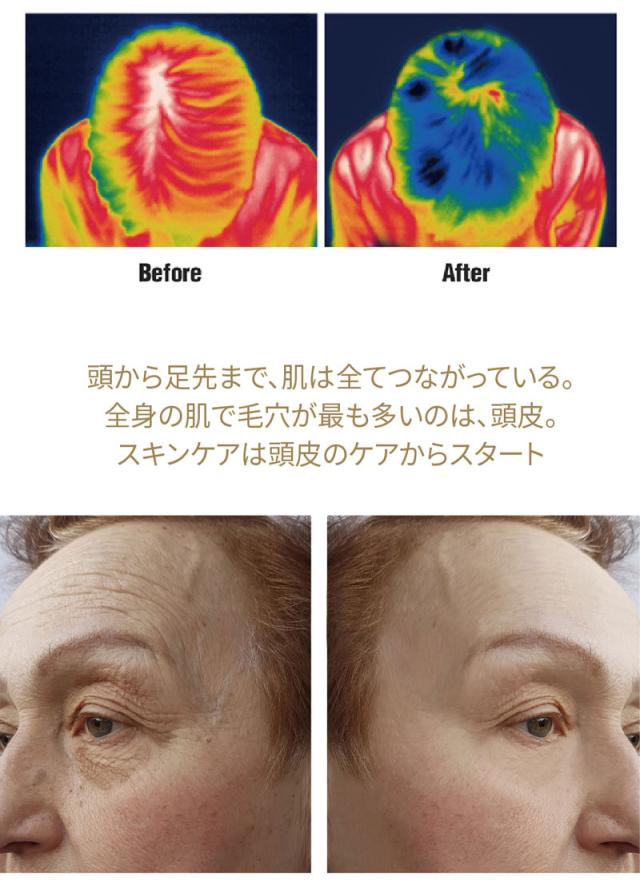 (2個セット) SallyZen ボリューマイジング ＆ スーディング トニック 100ml (送料無料) あす着_5