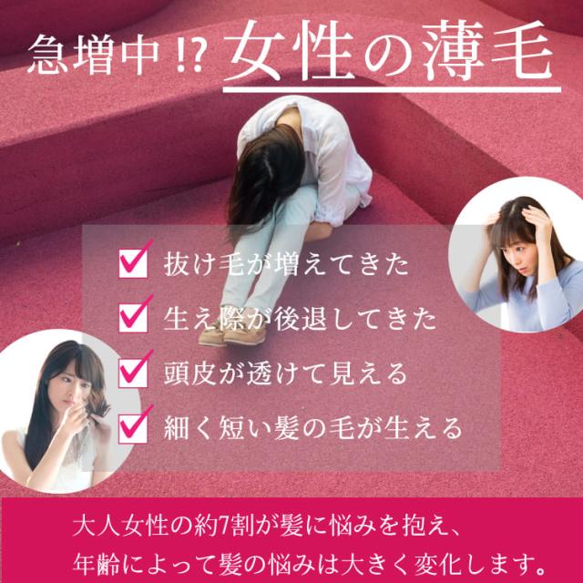 【第1類医薬品】MXプラスローション La 60ml×4個セット_2