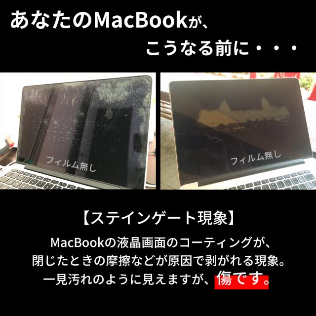 Apple MacBook 12インチ Retina フィルム 画面 保護 [ macbook12 