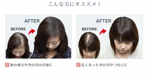 スーパーミリオンヘアー Smhヘアファンデーション 12g ブラック の通販はau Pay マーケット 愛らんどびゅーてぃ