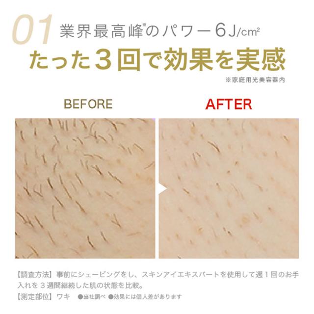 ブラウン 脱毛器 光脱毛 BRAUN 光美容器 シルクエキスパート PL-5137 ブラウン 脱毛器 光脱毛 家庭用 光脱毛器 ムダ毛処理 光美容器 シルクエキスパート ムダ毛ケア 顔 VIO Pro5 BRAUN Braun 送料無料_4