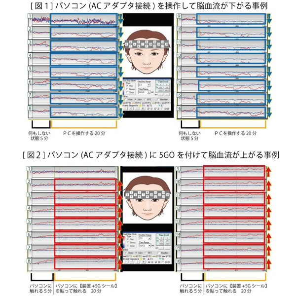 5GO TypeA 電磁波 ノイズ対策 USB 電磁波防止グッズ ユニカの通販はau