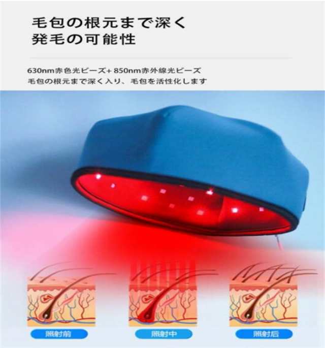 送料無料】育毛ヘルメット育毛キャップ 育毛システム120個 赤色 led 育毛 赤色光 育毛ヘルメット スカルプケア 治療ライト 育毛ケア  薄毛・抜け毛対策 発毛促進 植毛補強 増毛 発毛 養毛 頭皮ケア ヘアケア 脱毛 薄毛治療 毛髪ケアトの通販はau PAY マーケット - モダニク  ...