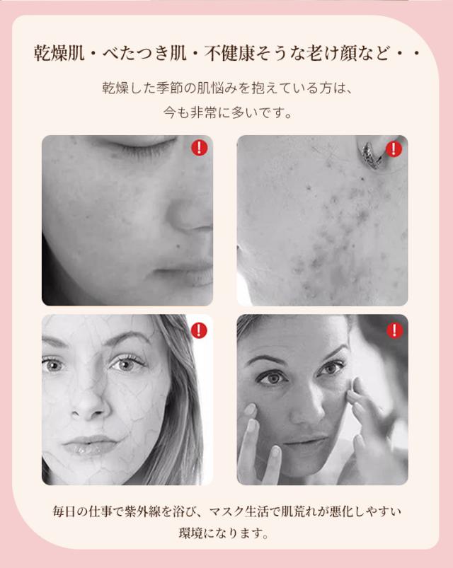 美顔器スチーマー フェイススチーマー 毛穴 保湿 フェイス スチーマー ナノミスト 冷 熱 ４段階モード フォトケア ヤーマン 温冷 スチーム スチーマー 美容 保湿 水道水OK たっぷりタンク 毛穴ケア 美容家電 フェイススチーマー 毛穴 保湿 フェイス スチーマー ナノミスト 冷 熱