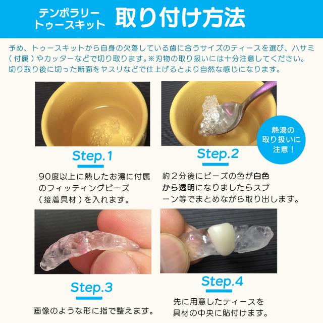 インスタントスマイル コンプリートキット 部分対応 抜け歯用 抜け歯