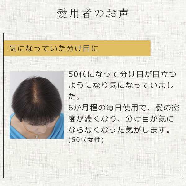 グロウエッセンス 育毛剤 女性用 ヘアーモーメントＰ 155ml 育毛 薄毛対策 薄毛 プレゼントの通販はau PAY マーケット -  美顔器・原液ならモテビューティー