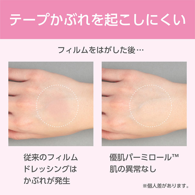 優肌パーミロール(ロールタイプ) 10cm×10m 14R10 1巻 ニトムズ【防水